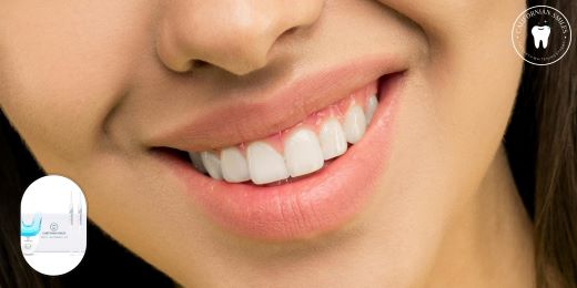 Qual è il metodo migliore per sbiancare i denti senza rischi per lo smalto?