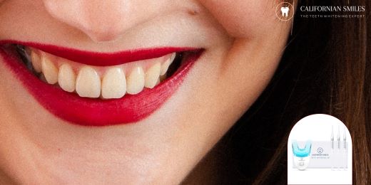 Lo sbiancamento dei denti a casa è sicuro per i miei denti?