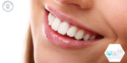 Come preservare lo smalto dei denti durante l'utilizzo di un kit di sbiancamento dei denti?