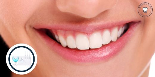 È possibile utilizzare un kit per lo sbiancamento dei denti durante la gravidanza?