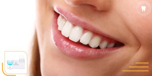 Un kit per lo sbiancamento dei denti può rimuovere le macchie di caffè e tè?