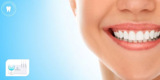 Quali sono i consigli per scegliere un kit per lo sbiancamento dei denti?