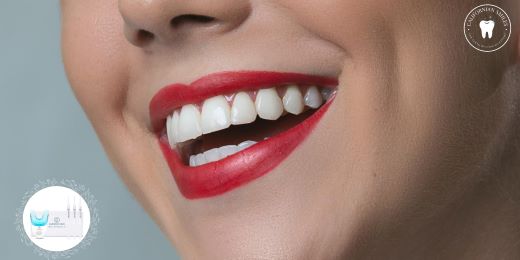 Quante volte alla settimana posso utilizzare un kit per lo sbiancamento dei denti?