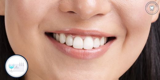 Come utilizzare un kit per lo sbiancamento dei denti?