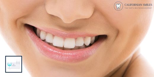 Quali sono gli errori comuni da evitare quando si utilizza un kit per lo sbiancamento dei denti?