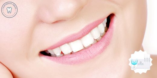 Come scegliere il momento giusto per iniziare il trattamento di sbiancamento dei denti?