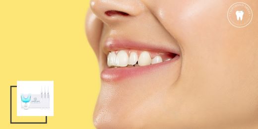 Quanto dura un kit per lo sbiancamento dei denti?