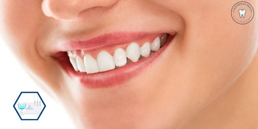 Come fai a sapere se un kit di sbiancamento dei denti è genuino e sicuro?